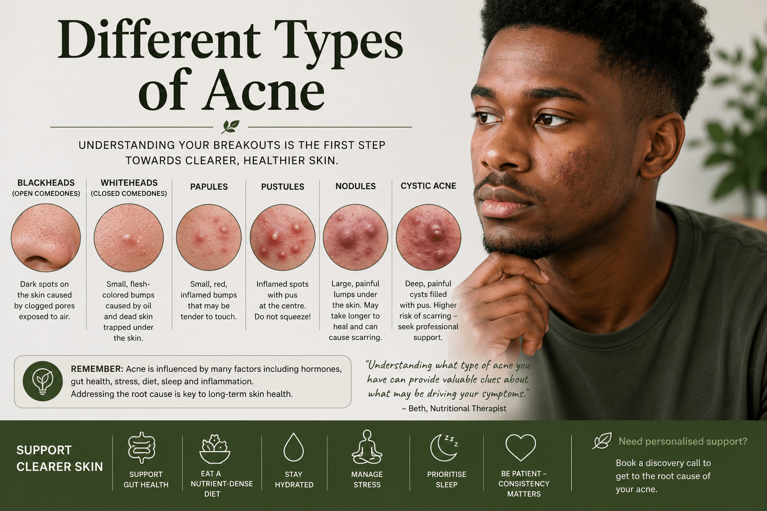 different types of acne